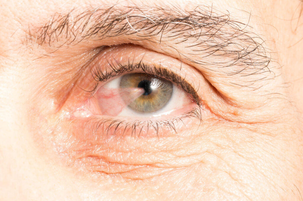 superfície ocular