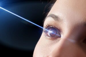 Referência ao tratamento para olho seco com luz intensa pulsada