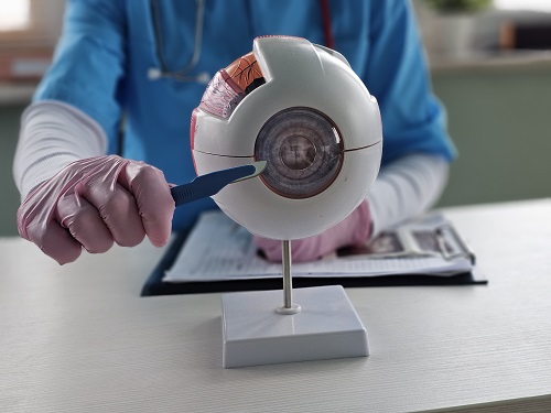 Protótipo de globo ocular sobre a mesa de um oftalmologista que, usando luvas cirúrgicas azuis, aponta com um bisturi a região da córnea.