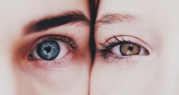 Close de 2 olhos, um com a íris castanho claro e outro com a iris azul.
Conceito de ceratopigmentação.