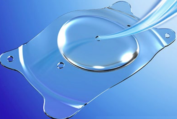 Lente intraocular fácica para alta miopia