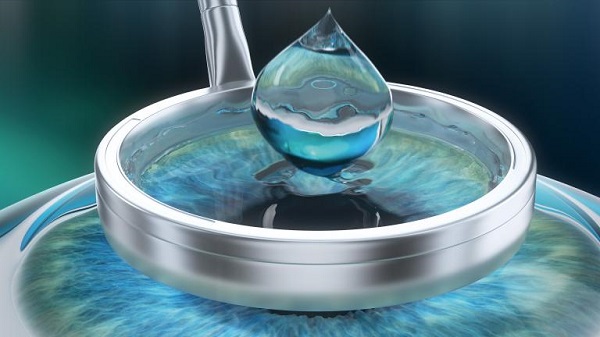 Cirurgia refrativa PRK