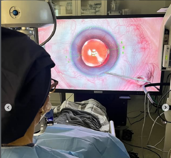 Dra Terla utilizando equipamento em 3D para realizar cirurgia ocular.