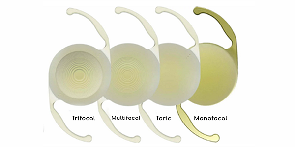 Diferentes tipos de entes intraoculares.