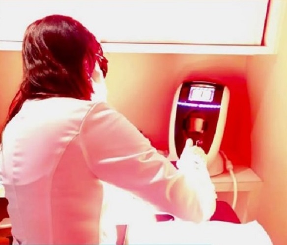 Dra. Terla aplicando luz pulsada no tratamento do olho seco evaporativo.